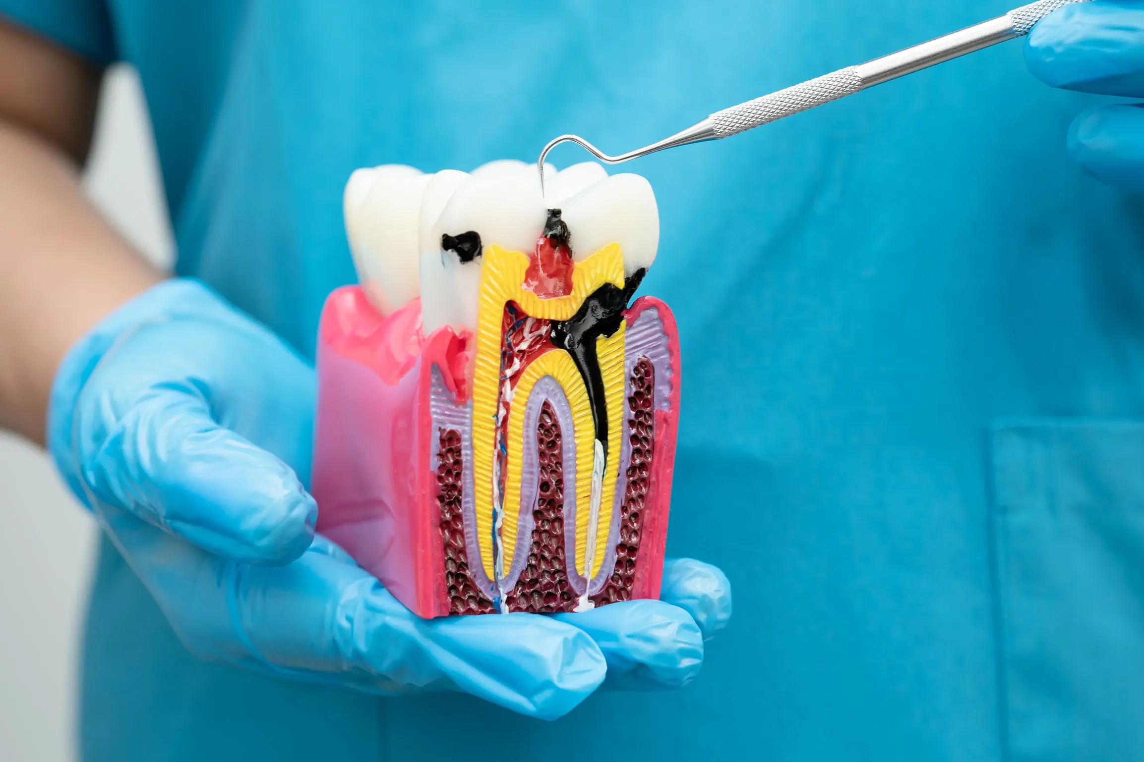 Ilustración anatómica mostrando la raíz del diente, corona, cemento dental, dentina y estructuras internas para comprender su funcionamiento. 